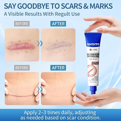 Silicone Scar Removing Cream