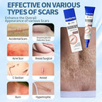 Silicone Scar Removing Cream