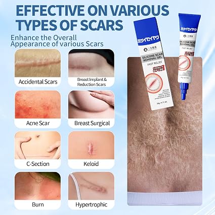 Silicone Scar Removing Cream